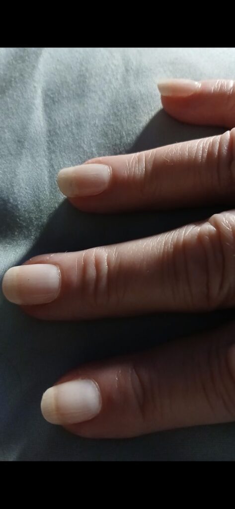 Image #1 from Teresa