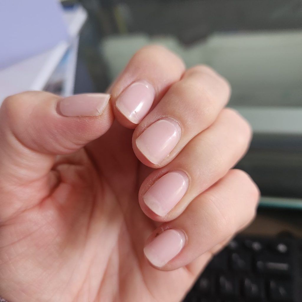 Image #1 from Kirsten